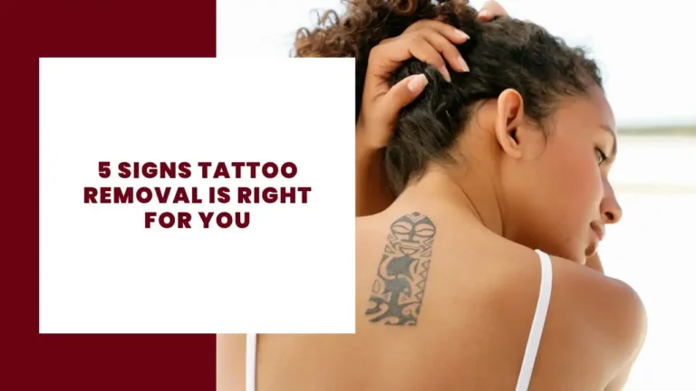 5 Signs Tattoo Removal Is Right for You